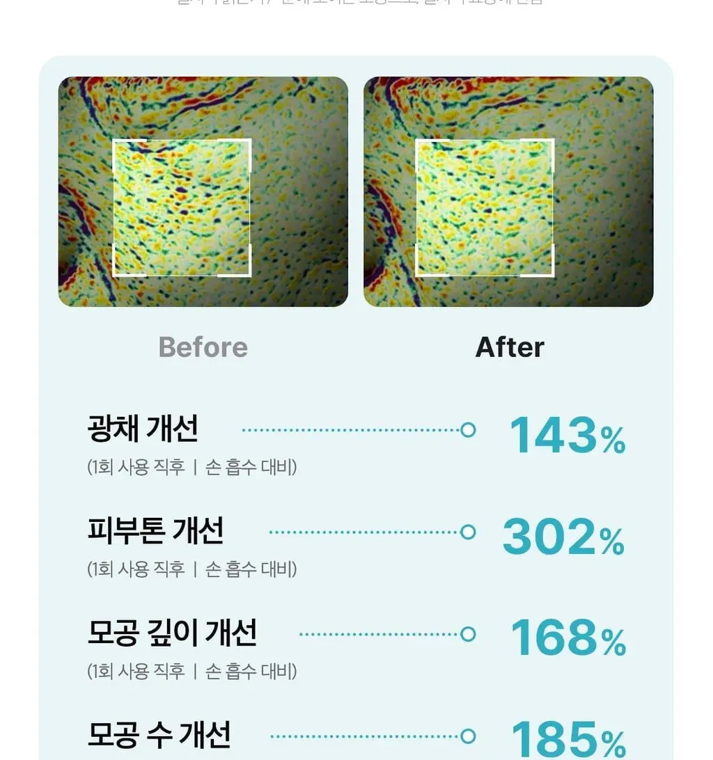 [스킨부스팅] 메디큐브 에이지알 미니플러스 핑크/베이지/짱구 에디션 상세페이지 12